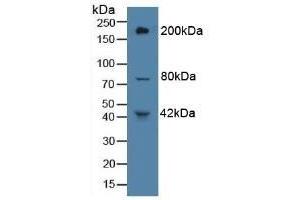 Detection of PTPRB in Rat Liver Tissue using Polyclonal Antibody to Protein Tyrosine Phosphatase Receptor Type B (PTPRB)