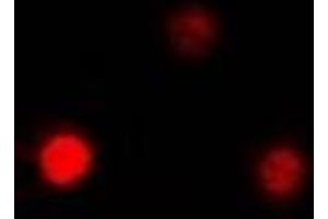 Immunofluorescent analysis of QKI staining in MCF7 cells. (QKI anticorps)