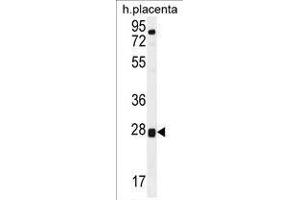 TOR2A Antibody (Center) western blot analysis in human placenta tissue lysates (35 µg/lane). (TOR2A anticorps  (Middle Region))