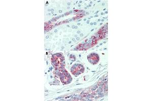 Immunohistochemical staining of human kidney (A) and human breast (B) with SLC4A2 polyclonal antibody . (SLC4A2 anticorps  (Internal Region))