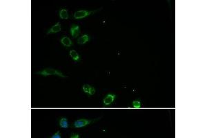 Immunofluorescence analysis of MCF-7 cells using HFE Polyclonal Antibody (HFE anticorps)