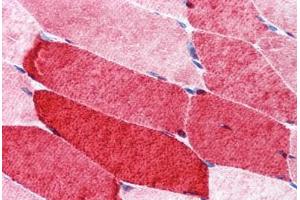 Human Skeletal Muscle: Formalin-Fixed, Paraffin-Embedded (FFPE)