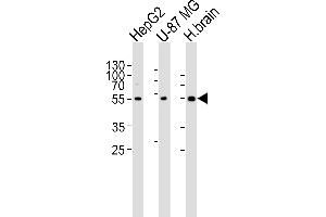 Western blot analysis of lysates from HepG2, U-87 MG cell line and human brain tissue lysate(from left to right), using RGS20 Antibody (Center) (ABIN6243829 and ABIN6577411). (RGS20 anticorps  (AA 150-184))