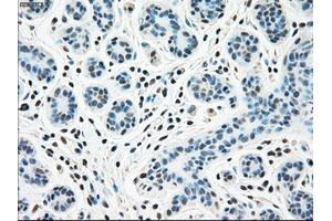 Immunohistochemical staining of paraffin-embedded breast tissue using anti-STK3 mouse monoclonal antibody. (STK3 anticorps)