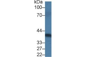 Detection of PRLR in Rat Serum using Polyclonal Antibody to Prolactin Receptor (PRLR)