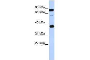 WB Suggested Anti-BCAP29 Antibody Titration:  0. (BCAP29 anticorps  (Middle Region))