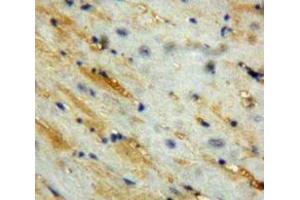 Used in DAB staining on fromalin fixed paraffin-embedded Heart tissue