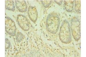 Immunohistochemistry of paraffin-embedded human colon tissue using ABIN7145070 at dilution of 1:100
