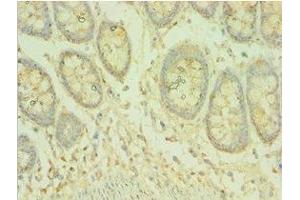 Immunohistochemistry of paraffin-embedded human colon tissue using ABIN7145070 at dilution of 1:100 (COQ8A anticorps  (AA 1-220))