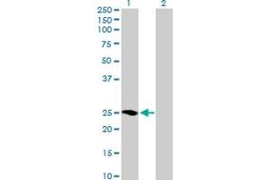 Western Blot analysis of MRAS expression in transfected 293T cell line by MRAS MaxPab polyclonal antibody. (MRAS anticorps  (AA 1-208))
