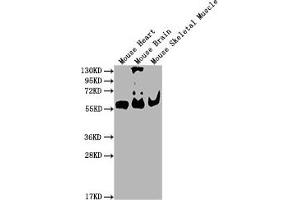 Western Blot Positive WB detected in: Mouse Heart tissue, Mouse Brain tissue, Mouse Skeletal Muscle tissue All lanes: PKM antibody at 1:4000 Secondary Goat polyclonal to Mouse IgG at 1/10000 dilution Predicted band size: 55-60 kDa Observed band size: 55-60 kDa (PKM anticorps  (AA 2-531))