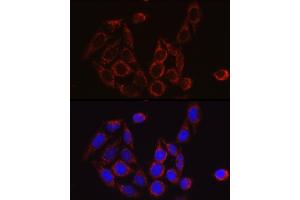 Immunofluorescence analysis of HeLa cells using SECISBP2 Rabbit pAb (ABIN6128699, ABIN6147497, ABIN6147498 and ABIN6222461) at dilution of 1:50 (40x lens).