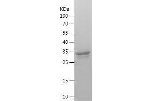 Western Blotting (WB) image for Inhibitor of Growth Family, Member 3 (ING3) (AA 1-92) protein (His-IF2DI Tag) (ABIN7123428)