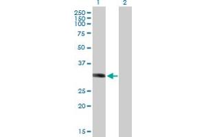 Western Blot analysis of LYSMD2 expression in transfected 293T cell line by LYSMD2 MaxPab polyclonal antibody. (LYSMD2 anticorps  (AA 1-215))