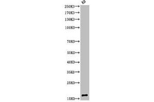 Western Blot analysis of KB cells using Acetyl-Histone H3 (K9) Polyclonal Antibody
