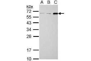WB Image SQSTM1 antibody [N3C1], Internal detects SQSTM1 protein by Western blot analysis.