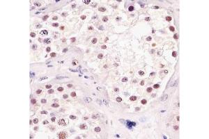 Immunohistochemical analysis of paraffin-embedded human testis using TBP antibody at 1:25 dilution. (TBP anticorps)