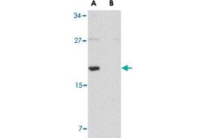 Western blot analysis of MED28 in human brain tissue lysate with MED28 polyclonal antibody  at 1 ug/mL in (A) the absence and (B) the presence of blocking peptide. (MED28 anticorps  (Internal Region))