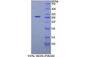SDS-PAGE analysis of Rat TGFb1I1 Protein. (TGFB1I1 Protéine)