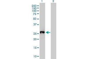Western Blot analysis of LXN expression in transfected 293T cell line by LXN monoclonal antibody (M01), clone 8H5. (Latexin anticorps  (AA 151-222))