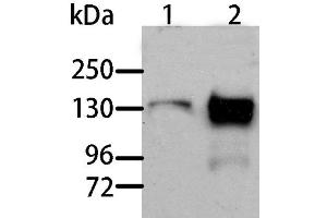 Western Blot analysis of Human liver cancer and normal liver tissue using AOX1 Polyclonal Antibody at dilution of 1:1000 (AOX1 anticorps)