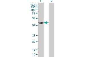 Western Blot analysis of STOML1 expression in transfected 293T cell line by STOML1 MaxPab polyclonal antibody. (STOML1 anticorps  (AA 1-398))