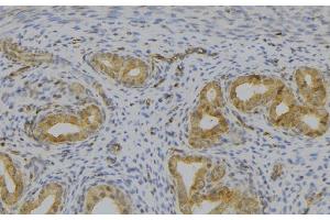 ABIN6277529 at 1/100 staining Human uterus tissue by IHC-P. (GHRH anticorps  (Internal Region))