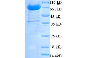 SDS-PAGE (SDS) image for ATPase, Na+/K+ Transporting, beta 1 Polypeptide (ATP1B1) (AA 47-529) protein (His-SUMO Tag) (ABIN5709105)