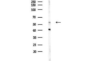 Western blot analysis of lysates from Hela cells(LPS 4h treatment), using p57 Kip2 Antibody at 1/1000 dilution.