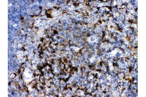 Anti- SQSTM1 Picoband antibody,IHC(P) IHC(P): Mouse Thymus Tissue