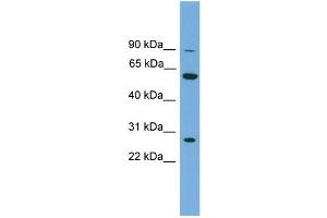 WB Suggested Anti-IMPDH2  Antibody Titration: 0. (IMPDH2 anticorps  (N-Term))