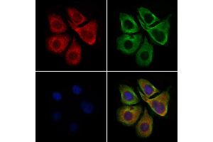 ABIN6257417 and ABIN6275853 staining HepG2 cells by IF/ICC.