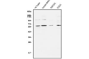 Western blot analysis of APEX2 using anti-APEX2 antibody (ABIN5518737). (APEX2 anticorps  (AA 102-210))