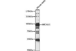 Western blot analysis of extracts of Mouse testis, using MIC antibody (ABIN7268510) at 1:1000 dilution.