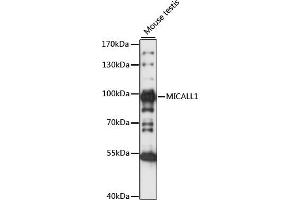 Western blot analysis of extracts of Mouse testis, using MIC antibody (ABIN7268510) at 1:1000 dilution. (MICAL-Like 1 anticorps  (AA 614-863))