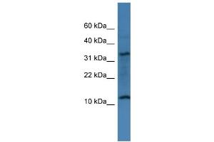 WB Suggested Anti-C14orf177 Antibody Titration: 0. (C14ORF177 anticorps  (N-Term))