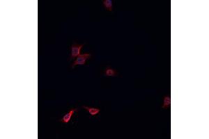 ABIN6268845 staining HeLa cells by IF/ICC. (NRF1 anticorps  (Internal Region))