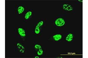 Immunofluorescence of monoclonal antibody to GABPA on HeLa cell.