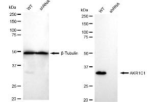 anti-AKR1C1, AKR1C2 antibody