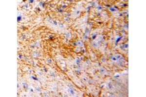 Used in DAB staining on fromalin fixed paraffin-embedded Brain tissue (CCL7 anticorps  (AA 24-97))