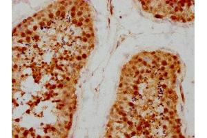 IHC image of ABIN7164157 diluted at 1:200 and staining in paraffin-embedded human testis tissue performed on a Leica BondTM system. (PRPF4 anticorps  (AA 120-266))