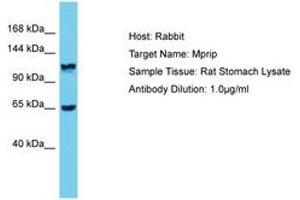 Image no. 1 for anti-Myosin Phosphatase rho Interacting Protein (MPRIP) (AA 771-820) antibody (ABIN6750397) (MPRIP anticorps  (AA 771-820))