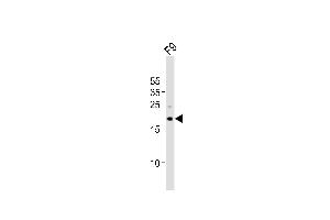 Western blot analysis of lysate from mouse F9 cell line, using (Mouse) Tdgf1 Antibody (N-term) (ABIN6243120 and ABIN6577808). (TDGF1 anticorps  (N-Term))