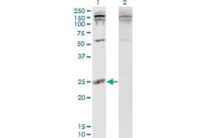 Western Blot analysis of PDAP1 expression in transfected 293T cell line by PDAP1 monoclonal antibody (M05), clone 3B10.