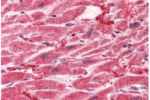 Human Heart (formalin-fixed, paraffin-embedded) stained with HES1 antibody ABIN307170 at 5 ug/ml followed by biotinylated goat anti-rabbit IgG secondary antibody ABIN481713, alkaline phosphatase-streptavidin and chromogen.