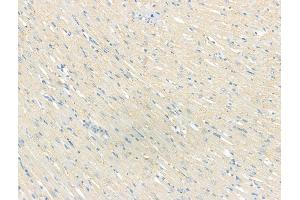 ABIN7094502 and ABIN7098551 at 1/100 staining Rat heart tissue by IHC-P. (Smoothelin anticorps  (C-Term))