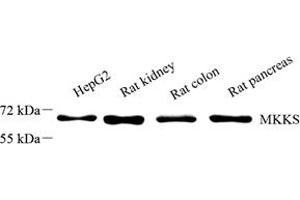 Western blot analysis of MKKS (ABIN7074572),at dilution of 1: 2000 (MKKS anticorps)