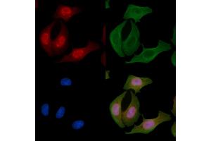 ABIN6256525 and ABIN6267600 staining Hela cells by IF/ICC.