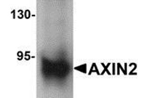 Western blot analysis of AXIN2 in mouse lung lysate with AXIN2 antibody at 1 μg/ml (AXIN2 anticorps  (C-Term))