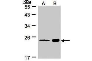 WB Image Sample(30 μg of whole cell lysate) A:MOLT4, B:Raji, 12% SDS PAGE antibody diluted at 1:500 (R-Ras anticorps  (Center))